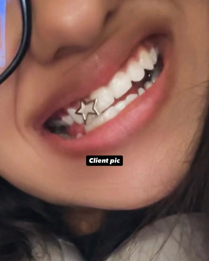 Star Teeth Grillz